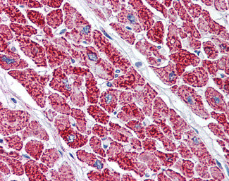 VDAC2 Antibody in Immunohistochemistry (Paraffin) (IHC (P))