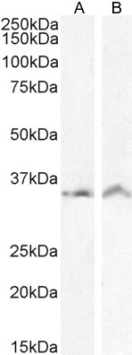 VDAC2 Antibody in Western Blot (WB)