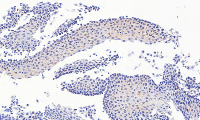 PAX3 Antibody in Immunohistochemistry (Paraffin) (IHC (P))