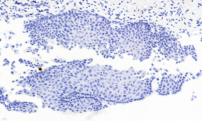 PAX3 Antibody in Immunohistochemistry (Paraffin) (IHC (P))