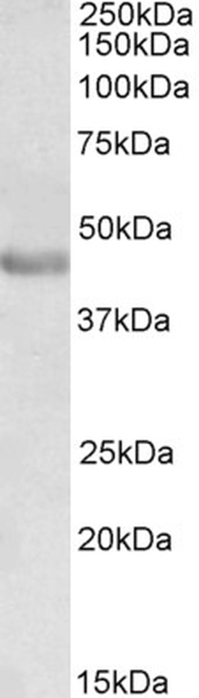 PAX3 Antibody in Western Blot (WB)