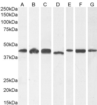 ACTR1A Antibody in Western Blot (WB)