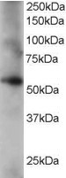 Coronin 3 Antibody in Western Blot (WB)