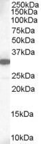 MCL-1 Antibody in Western Blot (WB)