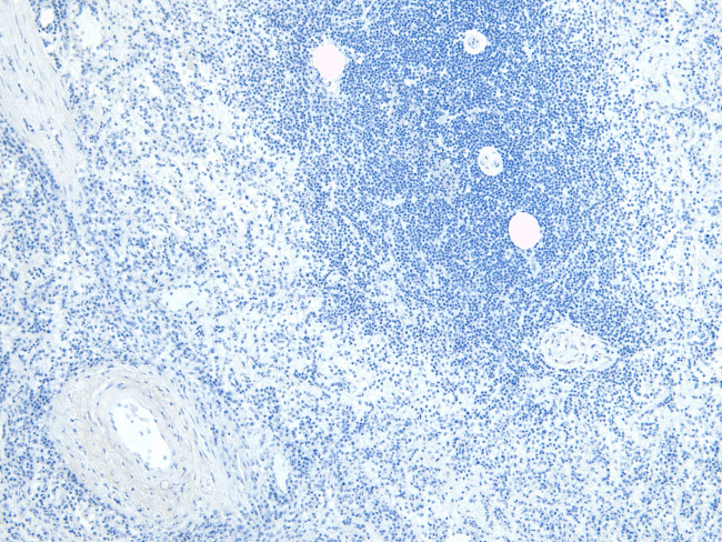 FLAP Antibody in Immunohistochemistry (Paraffin) (IHC (P))