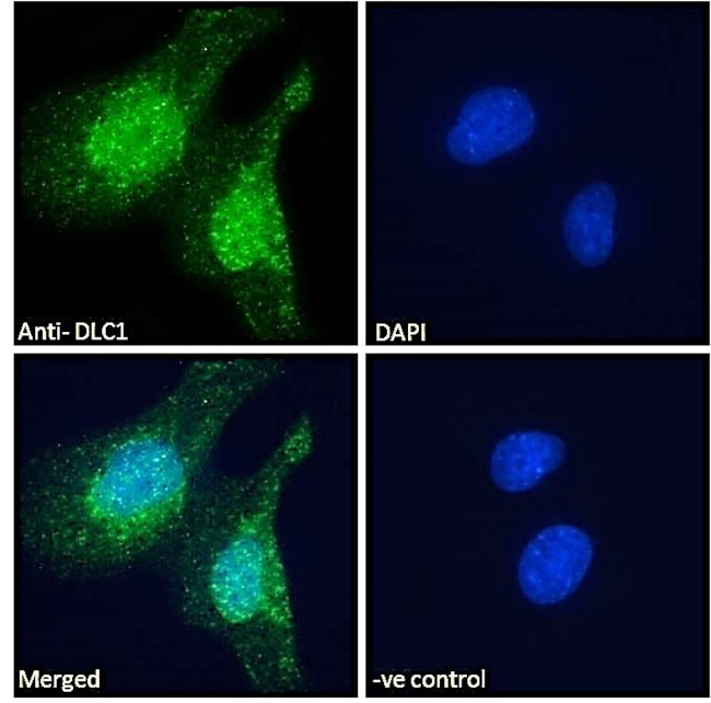 DLC1 Antibody in Immunocytochemistry (ICC/IF)