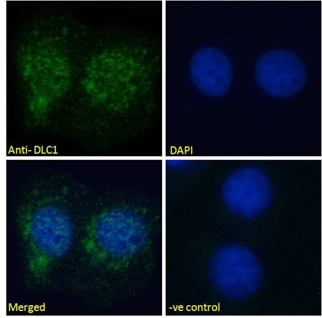 DLC1 Antibody in Immunocytochemistry (ICC/IF)