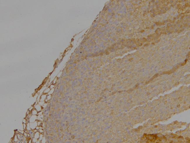 DLC1 Antibody in Immunohistochemistry (Paraffin) (IHC (P))