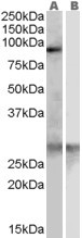 SCARF1 Antibody in Western Blot (WB)