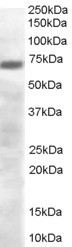 PRDM4 Antibody in Western Blot (WB)