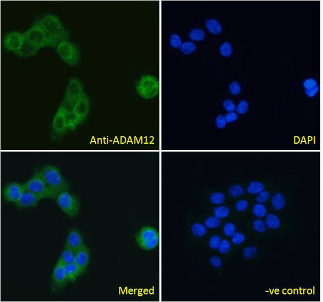 ADAM12 Antibody in Immunocytochemistry (ICC/IF)