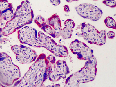 ADAM12 Antibody in Immunohistochemistry (Paraffin) (IHC (P))