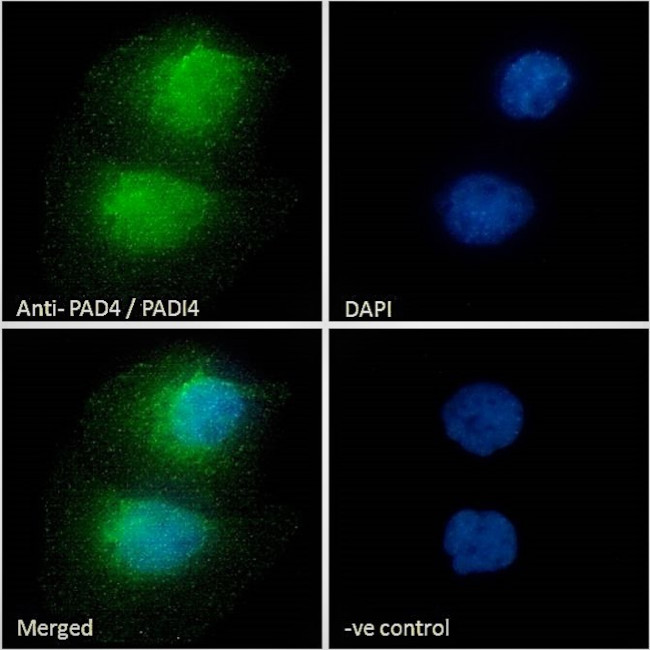 PADI4 Antibody in Immunocytochemistry (ICC/IF)