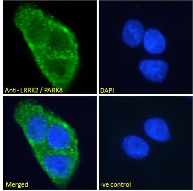 LRRK2 Antibody in Immunocytochemistry (ICC/IF)