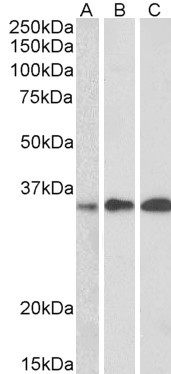 EFHD2 Antibody in Western Blot (WB)