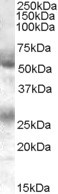 FLVCR1 Antibody in Western Blot (WB)