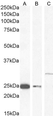 COMT Antibody in Western Blot (WB)