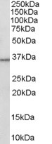 HSD11B1 Antibody in Western Blot (WB)