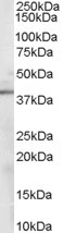 Sorbitol Dehydrogenase Antibody in Western Blot (WB)