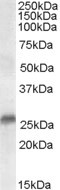 SRD5A2 Antibody in Western Blot (WB)