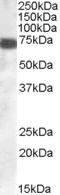 ZDHHC13 Antibody in Western Blot (WB)