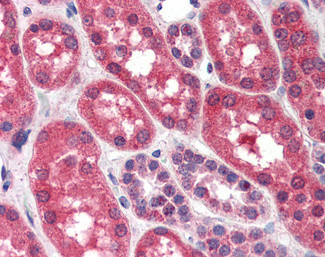 FGFR1 Antibody in Immunohistochemistry (Paraffin) (IHC (P))