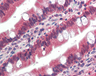 FGFR1 Antibody in Immunohistochemistry (Paraffin) (IHC (P))