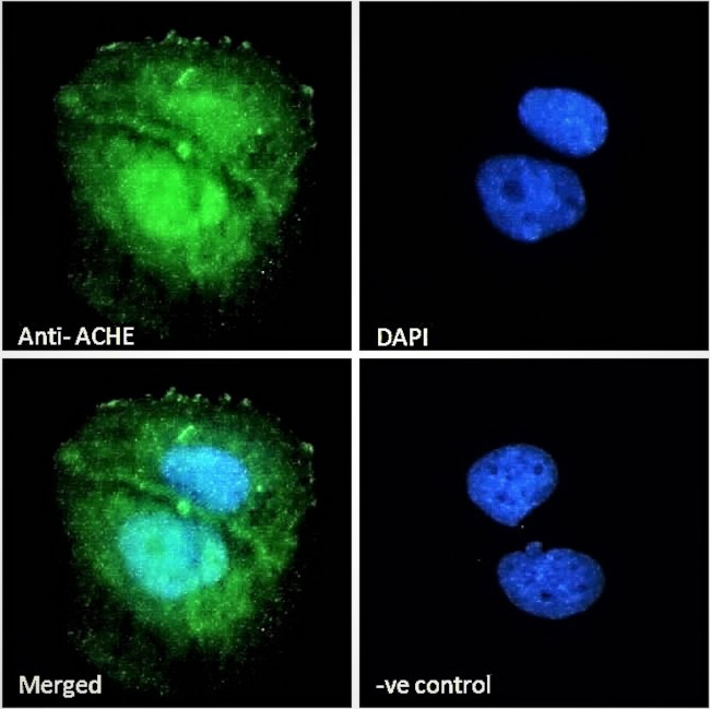 Acetylcholinesterase Antibody in Immunocytochemistry (ICC/IF)