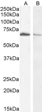 Acetylcholinesterase Antibody in Western Blot (WB)