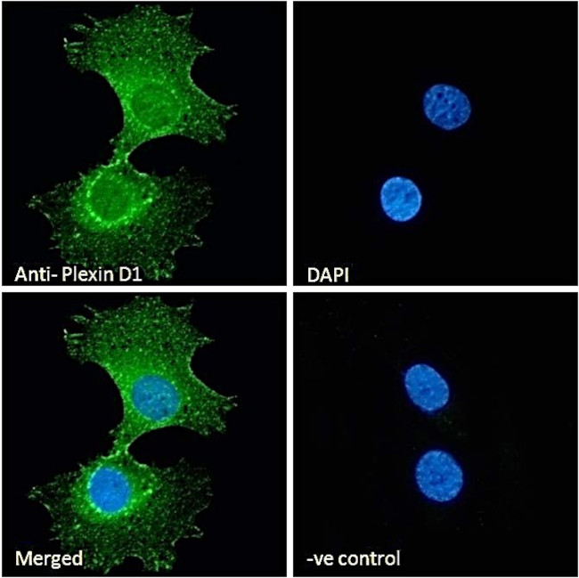 PLXND1 Antibody in Immunocytochemistry (ICC/IF)