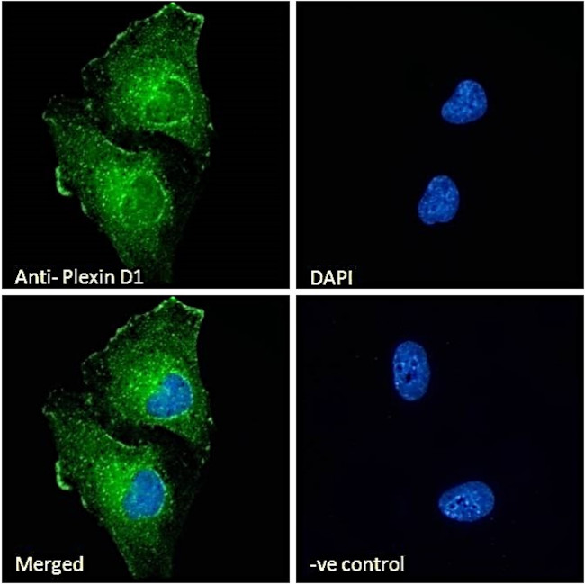 PLXND1 Antibody in Immunocytochemistry (ICC/IF)