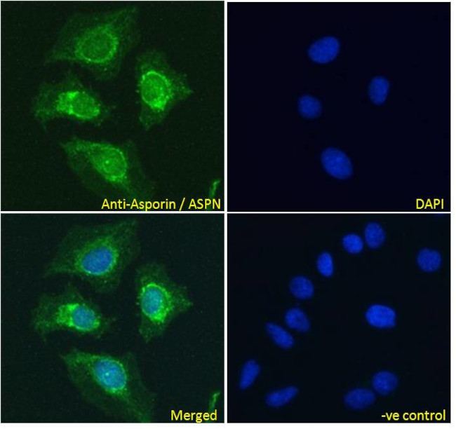 Asporin Antibody in Immunocytochemistry (ICC/IF)