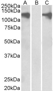 PUM2 Antibody in Western Blot (WB)