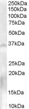 NANOS1 Antibody in Western Blot (WB)