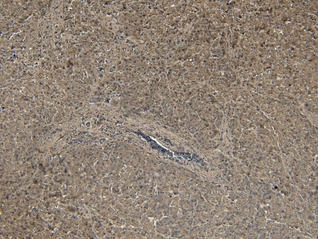 PCSK9 Antibody in Immunohistochemistry (Paraffin) (IHC (P))