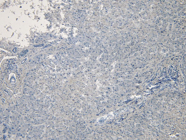 PCSK9 Antibody in Immunohistochemistry (Paraffin) (IHC (P))