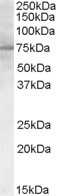 PCSK9 Antibody in Western Blot (WB)