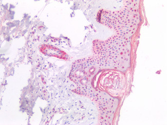 NPM1 Antibody in Immunohistochemistry (Paraffin) (IHC (P))