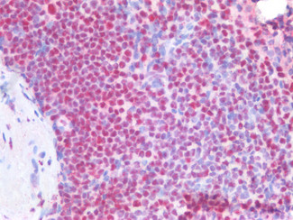 NPM1 Antibody in Immunohistochemistry (Paraffin) (IHC (P))