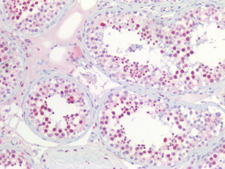 NPM1 Antibody in Immunohistochemistry (Paraffin) (IHC (P))