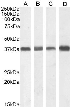 NPM1 Antibody in Western Blot (WB)