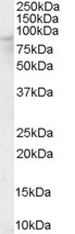 OSBP Antibody in Western Blot (WB)