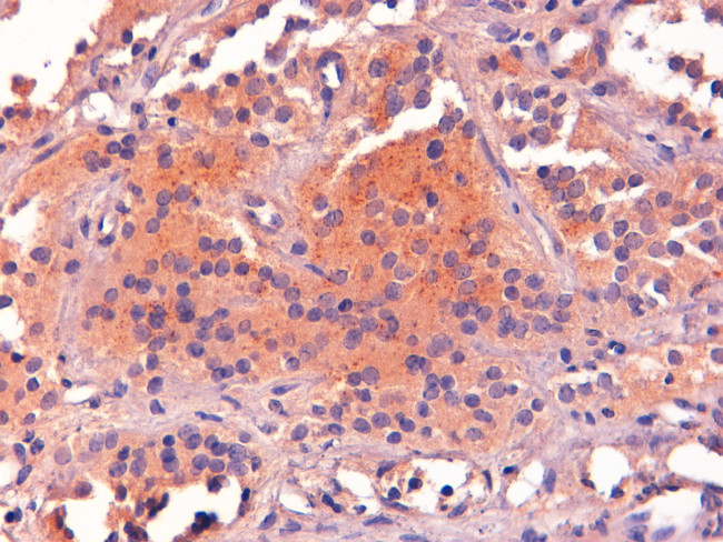 POMC Antibody in Immunohistochemistry (Paraffin) (IHC (P))