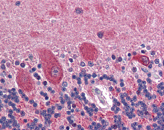 GAD65 Antibody in Immunohistochemistry (Paraffin) (IHC (P))