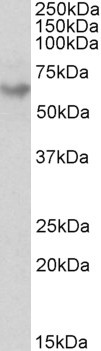 GAD65 Antibody in Western Blot (WB)