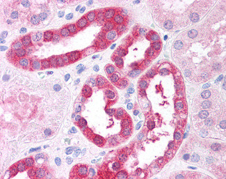 RICTOR Antibody in Immunohistochemistry (Paraffin) (IHC (P))