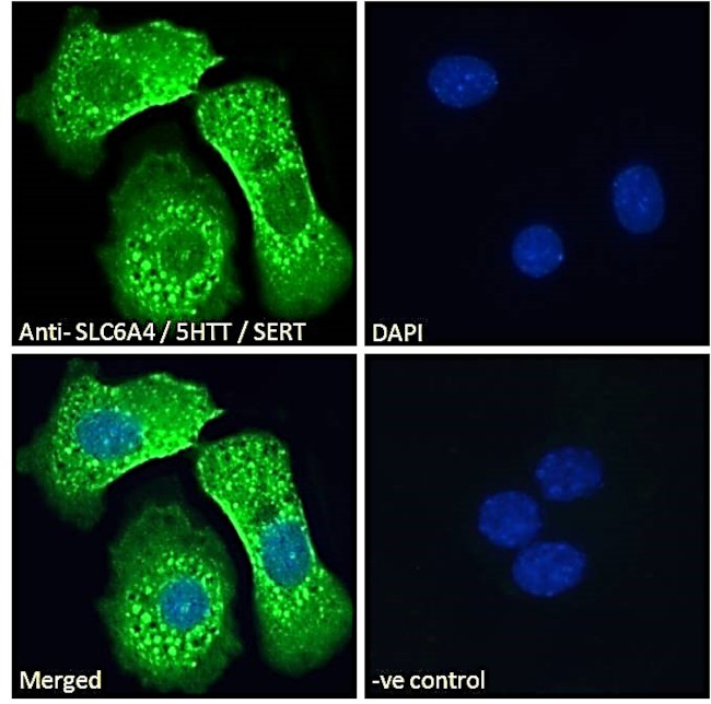 SLC6A4 Antibody in Immunocytochemistry (ICC/IF)