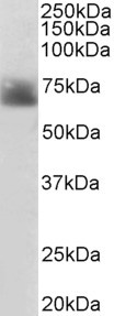 SLC6A4 Antibody in Western Blot (WB)