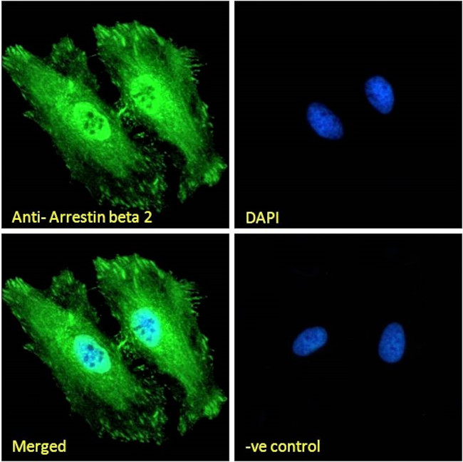 beta-Arrestin 2 Antibody in Immunocytochemistry (ICC/IF)