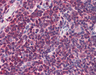 MIF Antibody in Immunohistochemistry (Paraffin) (IHC (P))